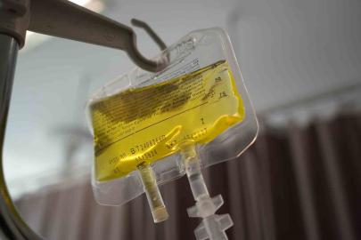 Doktorlardan ‘sarı serum’ uyarısı