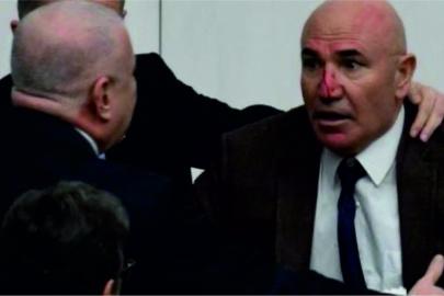 Mecliste kavga: Tanal burnundan yaralandı