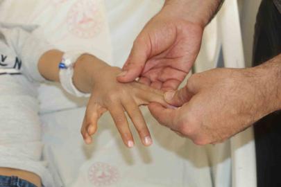 Yapışık parmaklı iki kardeş ameliyatla sağlıklarına kavuştu