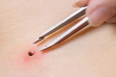 3 yaşındaki çocuğa kene tutundu, tedavi altına alındı