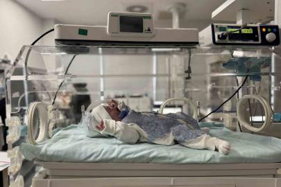 Nadir görülen hastalıkla doğan bebek sağlığına kavuştu