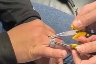 Parmağa sıkışan yüzük itfaiye ekiplerince çıkarıldı