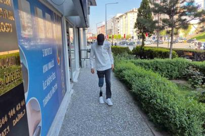 “15 Yaşındaki Çocuk Protezle Yeniden Özgür”
