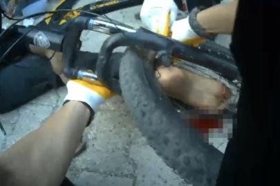 ayağı bisikletin tekerine sıkışan çocuk ekiplerce kurtarıldı